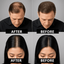 Sevich Follics Hair Fibers™ - Anti Hair Loss