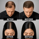 Sevich Hair Fibers™ Refill (100g)